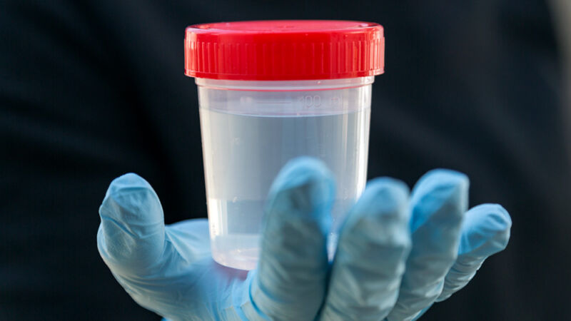 Close-up photograph of a glove hand holding a clear jar of foggy liquid.